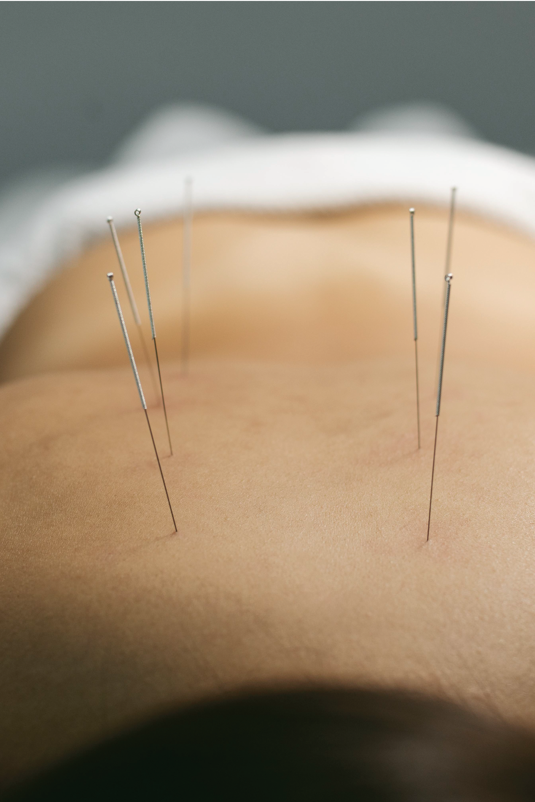 Hong's Health Care - Physiotherapy, Manual Osteopathy, Dry Needling, Personal Training & Massage Therapy Clinic in Downtown Ottawa